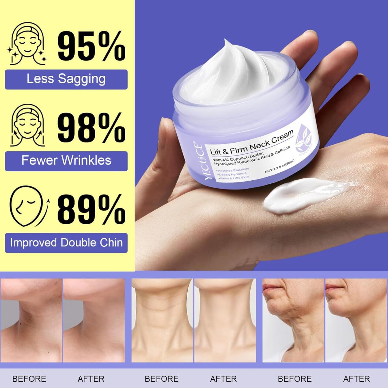 Anti-aging Cream for Neck and Décolleté
